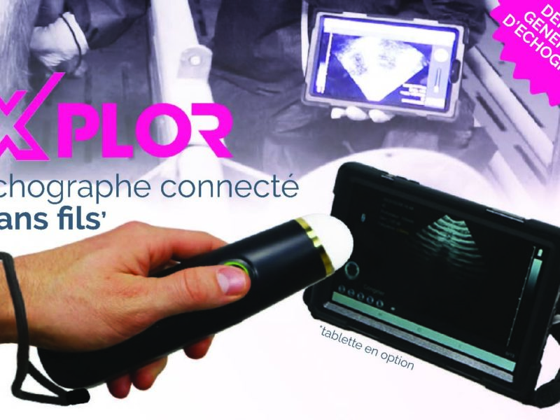 XPLOR : échographe connecté ‘sans fils’