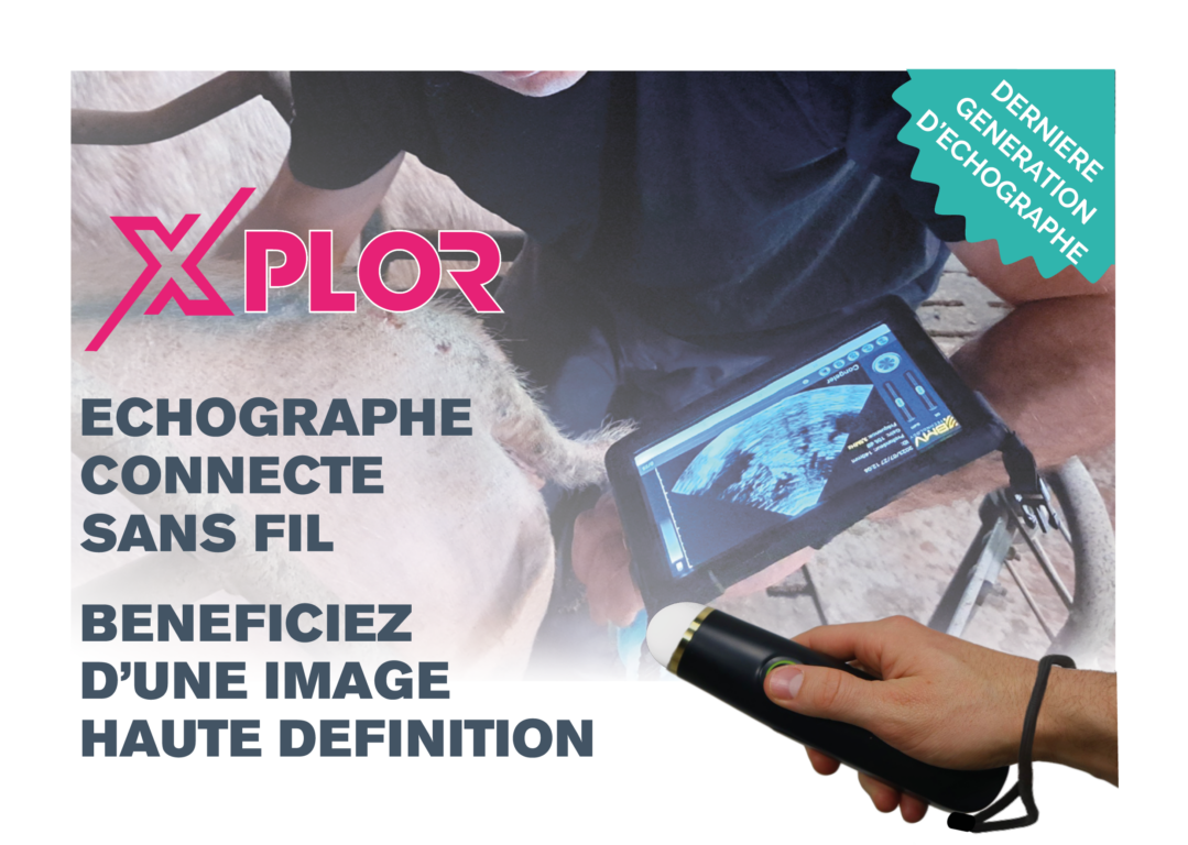 X’PLOR échographe connecté : reportage Dominique LANNON