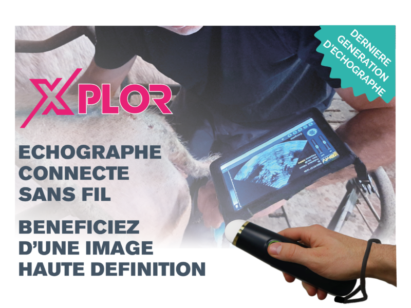 X’PLOR échographe connecté : reportage Dominique LANNON